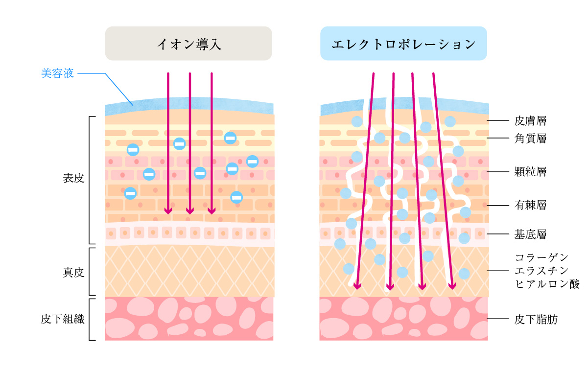 イオンとエレクトロポレーションの比較