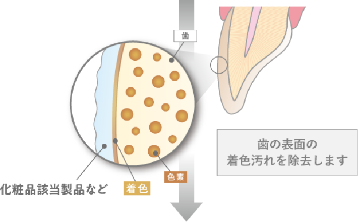 化粧品該当製品、歯の表面の着色汚れを除去します